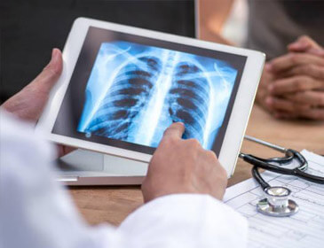 Dra Vanessa Lago, médica pneumologista em São João da Boa Vista. Tratamento de Embolia Pulmonar
